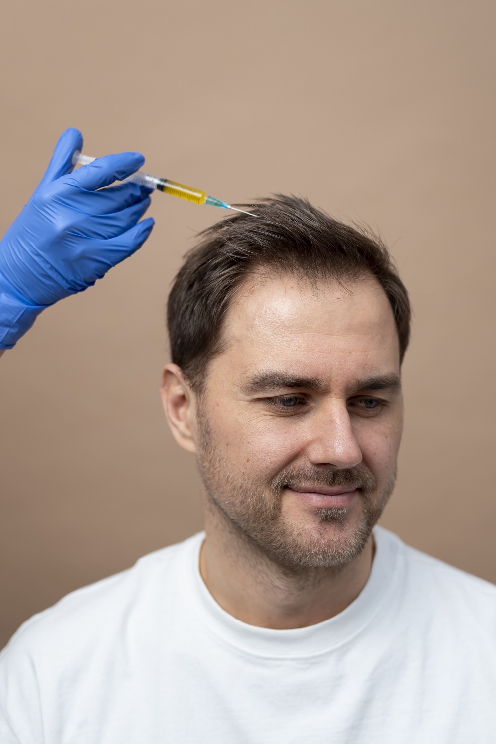 hair transplant in greater noida